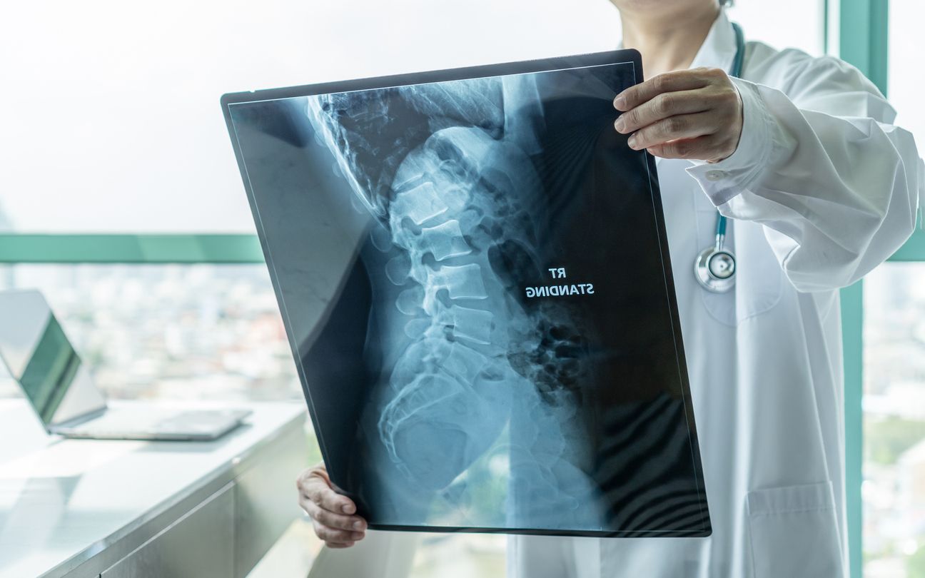 Understanding Herniated Disc C4/C5 and C5/C6...