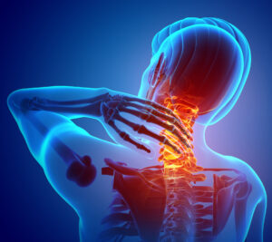 Neck Injury and Pain After a...