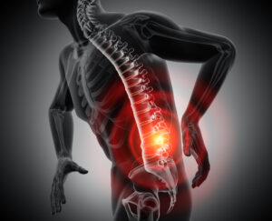 Low Back Injury and Pain After...